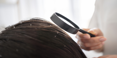 LA ASTENIA PRIMAVERAL TAMBIÉN PUEDE INFLUIR EN LA CAÍDA DEL CABELLO