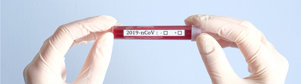 Coronavirus